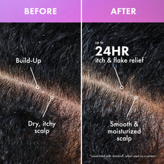Lavender & Lychee Scalp Soothing Daily Refresher